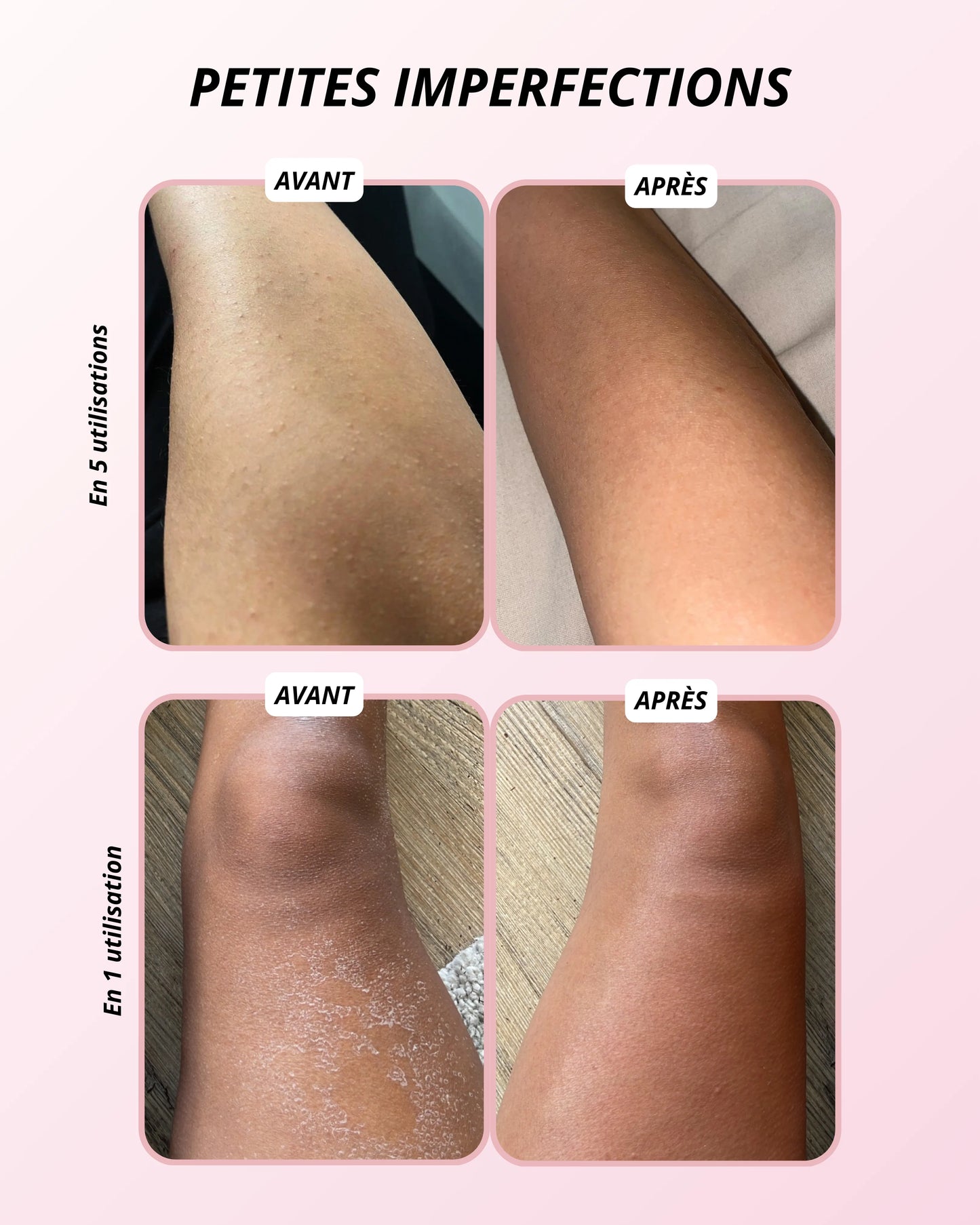 Gant Exfoliant Corps – Élimine les Peaux Mortes, Lisse et Adoucit la Peau